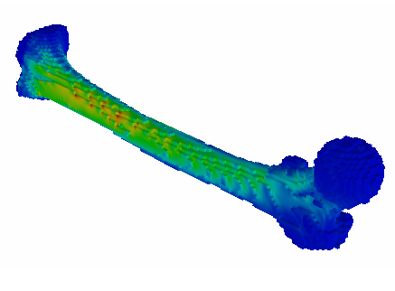 Stress analysis of physiological femur